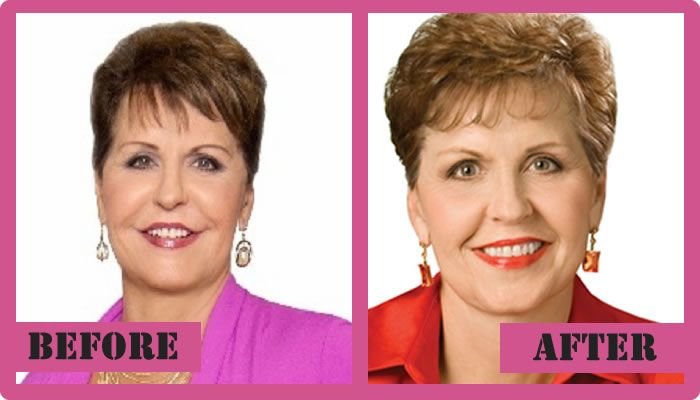 Joyce Meyer Plastic Surgery Personal Fall Of A Religious Woman