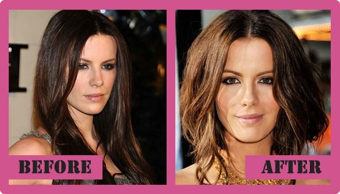 Kate Beckinsale Plastic Surgery Was Excellent