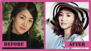 Park Min Young Plastic Surgery - Is One Of The Most Excellent Surgeries ...